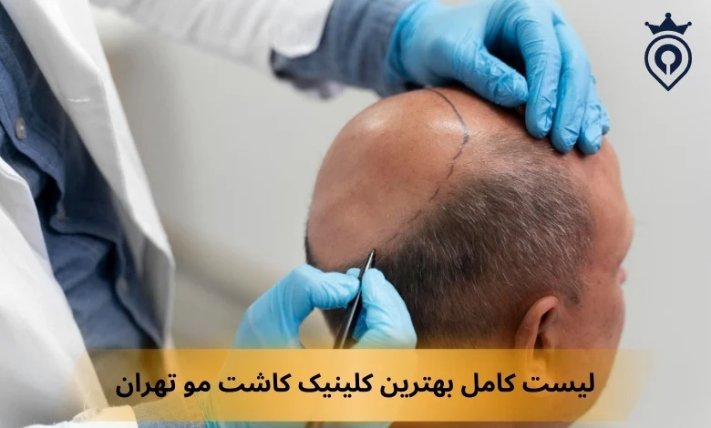بهترین کلینیک کاشت مو تهران