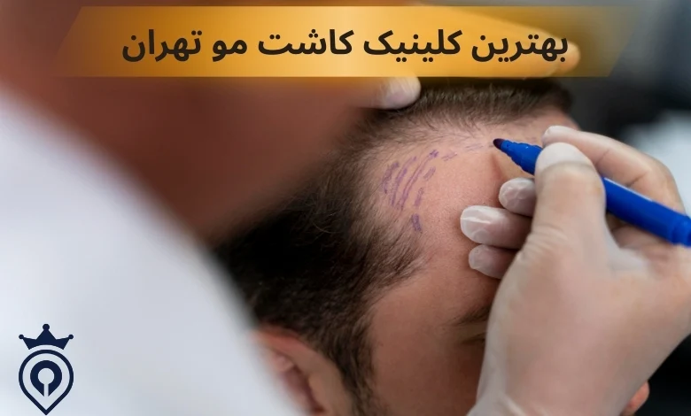 بهترین کلینیک کاشت مو تهران