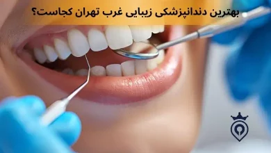 بهترین دندانپزشک زیبایی غرب تهران