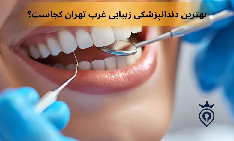 بهترین دندانپزشک زیبایی غرب تهران