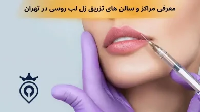تزریق ژل لب روسی در تهران