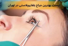 بهترین جراح بلفاروپلاستی در تهران