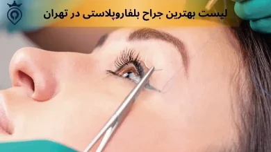 بهترین جراح بلفاروپلاستی در تهران