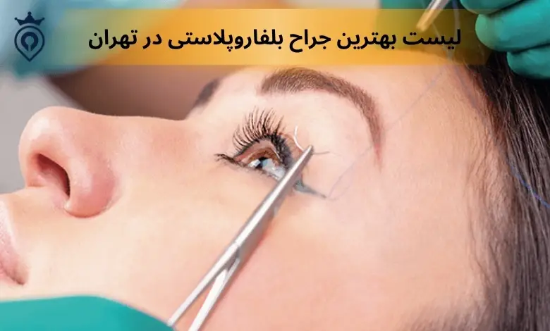 بهترین جراح بلفاروپلاستی در تهران