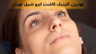 کاشت مژه شرق تهران