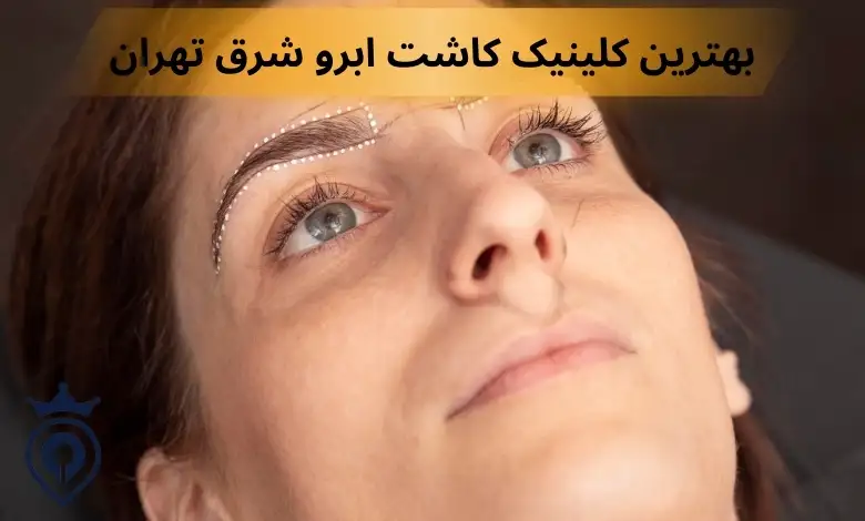 کاشت مژه شرق تهران