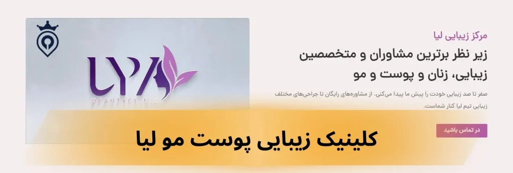 کاشت ابرو در غرب تهران