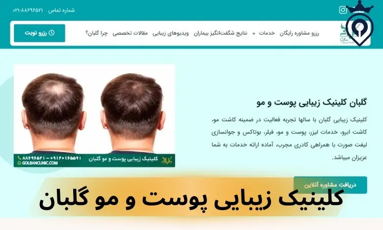 کاشت ابرو در غرب تهران