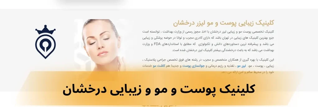 کاشت ابرو در غرب تهران