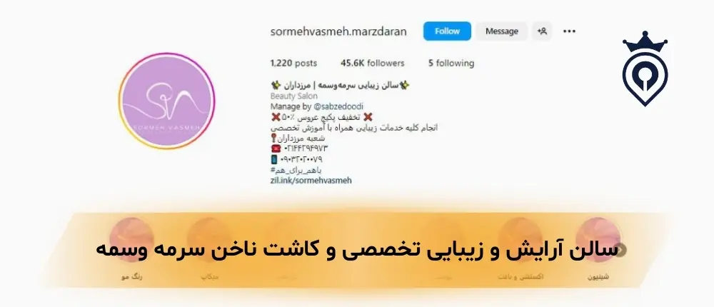 کاشت ناخن در غرب تهران