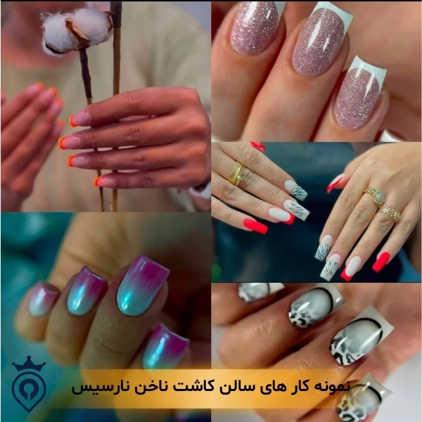 کاشت ناخن در پیروزی
