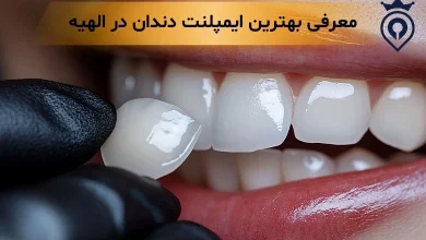 لمینت دندان در الهیه