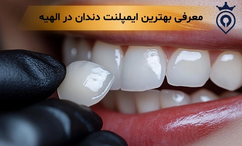 لمینت دندان در الهیه