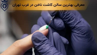 کاشت ناخن در غرب تهران