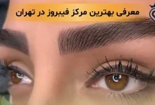 فیبروز ابرو در تهران