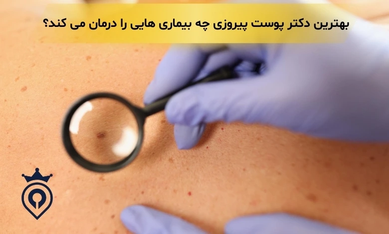 بهترین متخصص پوست در پیروزی