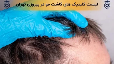 کاشت مو در پیروزی