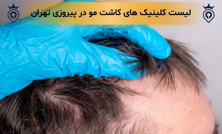 کاشت مو در پیروزی