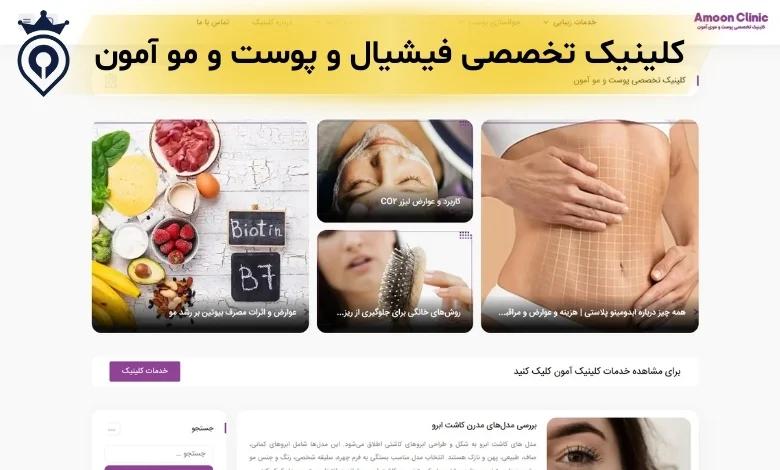 فیشیال در میرداماد