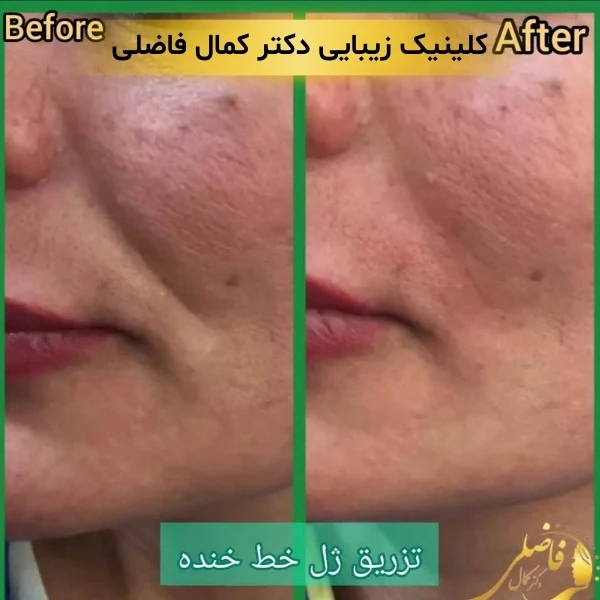 کلینیک زیبایی در پیروزی