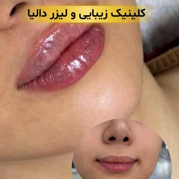 کلینیک زیبایی در پیروزی