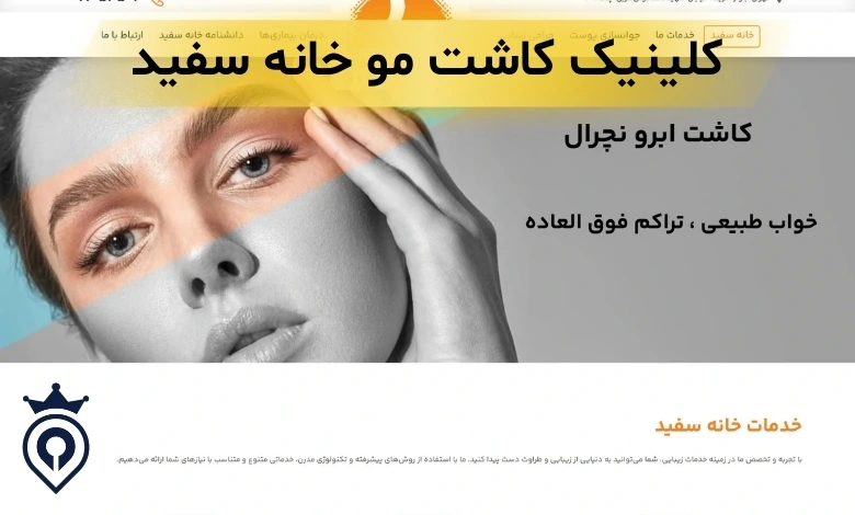 بهترین کلینیک کاشت مو جردن تهران