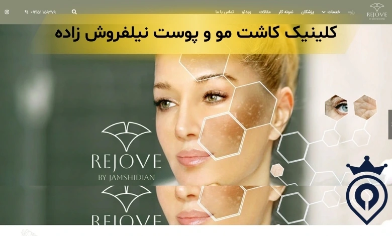 کلینیک کاشت مو جردن