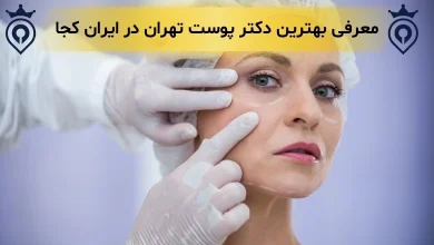 بهترین دکتر پوست در تهران - بهترین متخصص پوست در تهران - دکتر پوست در تهران