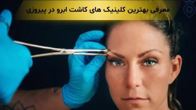 کاشت ابرو در پیروزی