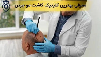 بهترین کلینیک کاشت مو جردن تهران