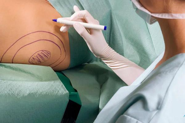 ویژگی‌های بهترین دکتر ویزر لیپو