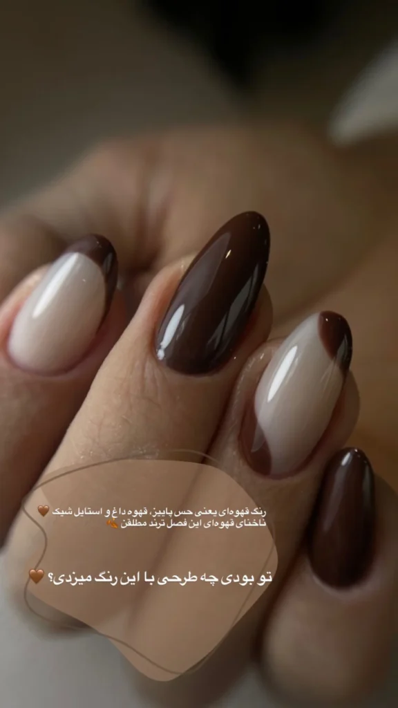 کاشت ناخن در زعفرانیه